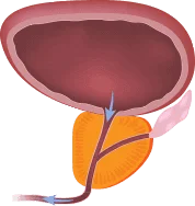 Schéma de la prostate sous la vessie
